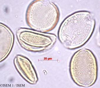 ISEM 1/Xanthorrhoea_quadrangulata_29401/Xanthorrhoea_quadrangulata_29401_0001(copy)_thumb.jpg